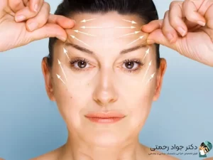 بهترین جراح لیفت شقیقه در تهران