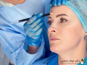 هزینه لیفت شقیقه در سال 1402